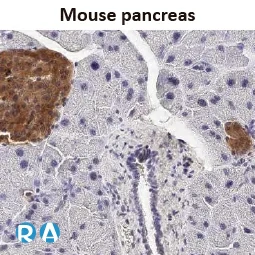GLP1R antibody [HL2297]